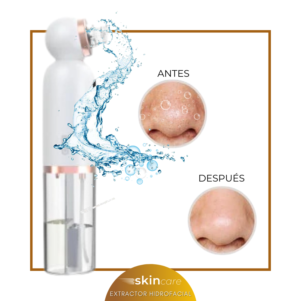 🧼 Removedor Extractor Hidrafacial | Dile Adiós a los Puntos Negros y Hola a una Piel Limpia y Radiante ✨