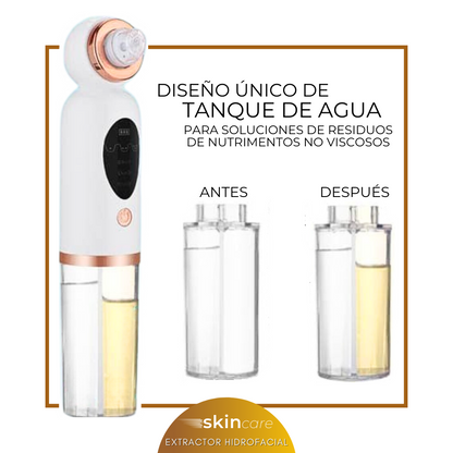 Removedor Extractor Hidrafacial Puntos Negros